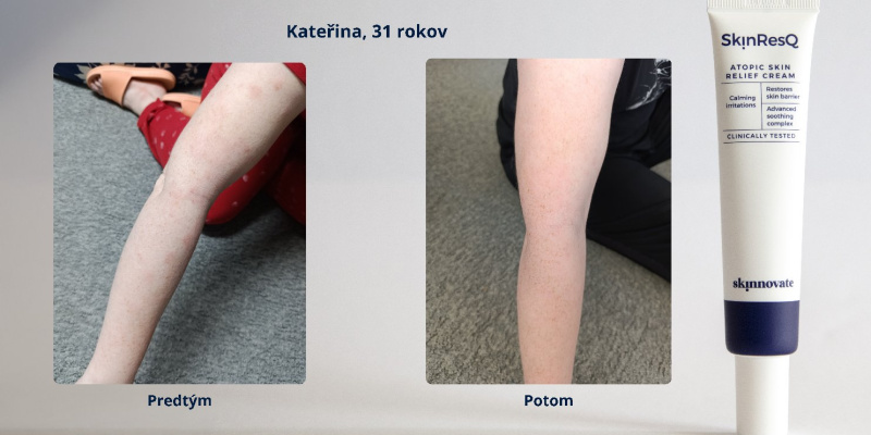 Katerina, 31r